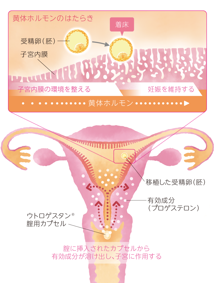 腟用カプセルとは?